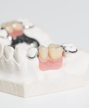 Dentallabor Gunzelmann Bild 3
