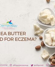 Affiliated Dermatology Tolleson image 13