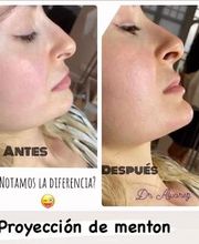 Theys Belleza imagen 5