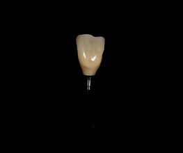 ModeLab Dental Bild 5