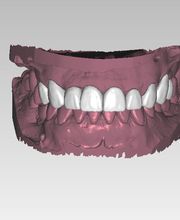 Clínica Dental Vitaldent imagen 13