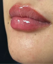 Zen Luxe Medspa & IV Lounge image 1