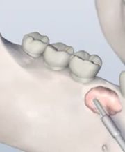 Philip M Robitaille, D.D.S. & Associates image 9