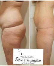 Centro Estetico Oltre L'Immagine di Lidia Schiavo Bild 12