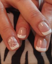 Epile Et Face image 12