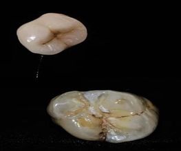 corona-dental-08-g.jpg