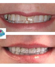 Flawless Smile Dentistry Claremore image 16