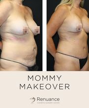 Renuance Cosmetic Surgery and MedSpa image 14