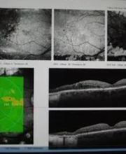 Healthyeye Vision Bild 8