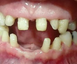 Clínica Dental Quart imagen 10