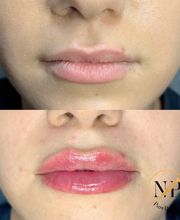 PureBeautyNP Aesthetics image 3