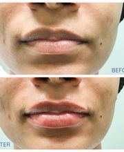 dermani MEDSPA Mansfield image 14