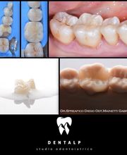 Dentalp SA Bild 5
