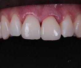 ModeLab Dental Bild 19
