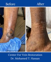 Center for Vein Restoration | Dr. Mohamed Hassan image 2