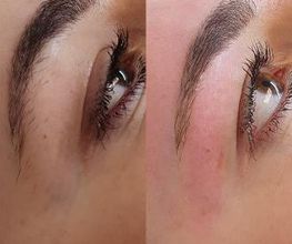 QueBonita Brazilian Waxing & Laser Leipzig Bild 17
