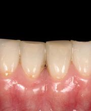 Clínica Dental Dres. Nuñez García imagen 5