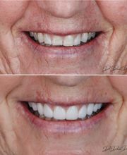 Great Neck Dental Arts image 4