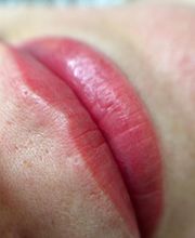 Micropigmentación para tí imagen 8