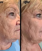 Wrinkle Free WA image 8