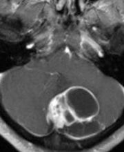 Prof. Dr. med. Merlo Adrian Bild 5