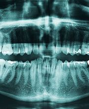 ZNZ Zahnärztliche Notfall Zentrale Bild 3