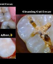 Northeast Lincoln Family Dentistry image 12