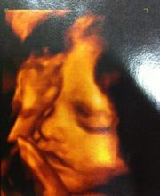 Sonia Martínez Morales Ginecóloga imagen 4