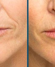 Lift Aesthetics image 2