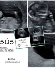 See Baby Ecografía Emocional imagen 3