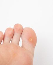 Clínica del pie Lucia Padilla García imagen 5