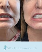 Sonterra Dermatology at The Pearl image 11