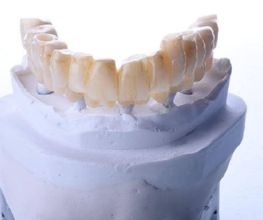 centre-odontologia-miret-puig-maqueta-dental-03.jpg