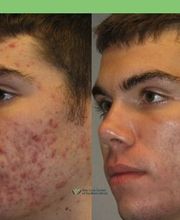 Schweiger Dermatology Group - Glen Carbon image 8