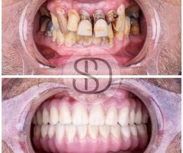 Supreme Dental Clinic imagen 12