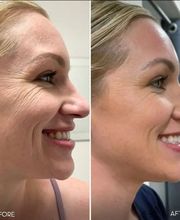 New Image Anti Aging & Weight Loss Center image 6