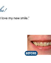 Rotem Dental Care image 12
