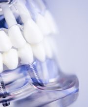 Il Dentista Dr. Alessandro Rossi SA Bild 9