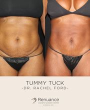 Renuance Cosmetic Surgery and MedSpa image 12