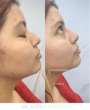 Dr Alexis Fernandez | Medicina Estetica imagen 5