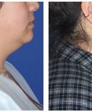 Ethos Plastic Surgery: Ginger Xu, M.D. image 4