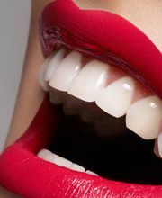 Naturlife Dental Mendrisio - Dr. Bontempelli Lorenzo Bild 7