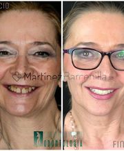 Clínica Dental Reina Victoria 66 imagen 7