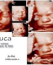 See Baby Ecografía Emocional imagen 14