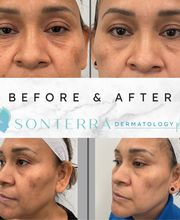 Sonterra Dermatology image 9