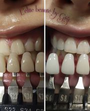 L'Elite Beauté 04 image 5