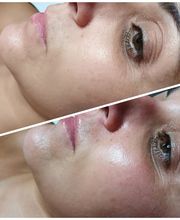 CENTRO ESTÉTICO ESTHER CABALLERO imagen 6