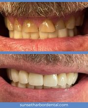 Sunset Harbor Dental image 11