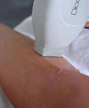 Dauerhafte Haarentfernung - Remove Laserzentrum Stuttgart Bild 8