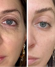 Wrinkle Free WA image 4